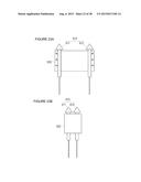 URETHRAL STRICTURE TREATMENT METHOD diagram and image