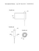 URETHRAL STRICTURE TREATMENT METHOD diagram and image