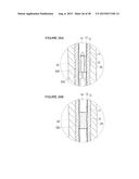 URETHRAL STRICTURE TREATMENT METHOD diagram and image