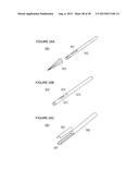 URETHRAL STRICTURE TREATMENT METHOD diagram and image