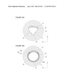 URETHRAL STRICTURE TREATMENT METHOD diagram and image