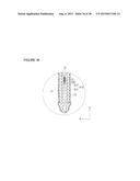 URETHRAL STRICTURE TREATMENT METHOD diagram and image