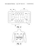 ELECTRODE WITH REDUNDANT IMPEDANCE REDUCTION diagram and image