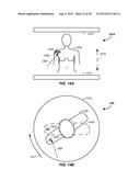 MULTI-AXIS CHARGED PARTICLE CANCER THERAPY METHOD AND APPARATUS diagram and image