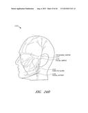 ENERGY-BASED TISSUE TIGHTENING SYSTEM diagram and image