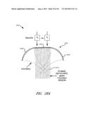 ENERGY-BASED TISSUE TIGHTENING SYSTEM diagram and image