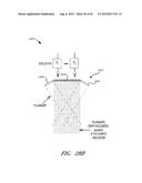 ENERGY-BASED TISSUE TIGHTENING SYSTEM diagram and image