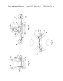 APPARATUS AND A METHOD  FOR DEWATERING WOOD CHIPS diagram and image