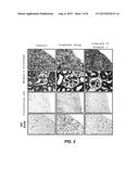 COMPOSITION FOR PREVENTING OR TREATING KIDNEY DISEASE COMPRISING PYRAZOLE     DERIVATIVE diagram and image