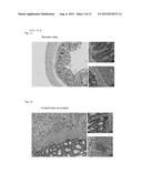 COMPOSITIONS AND METHODS FOR DIAGNOSING AND TREATING AN INFLAMMATION diagram and image