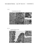 COMPOSITIONS AND METHODS FOR DIAGNOSING AND TREATING AN INFLAMMATION diagram and image