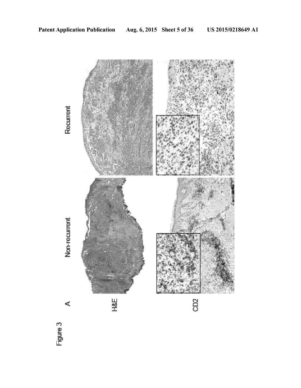 BIOMARKER ASSOCIATED WITH RISK OF MELANOMA REOCCURRENCE - diagram, schematic, and image 06