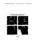 METHODS FOR THE DETECTION OF JC POLYOMA VIRUS diagram and image