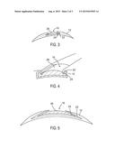 MOVABLE OPHTHALMIC LENS ASSEMBLY diagram and image