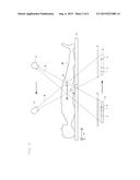 TRABECULAR BONE ANALYZER diagram and image