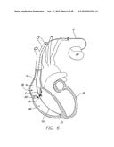 IMPLANTABLE ECHO DOPPLER FLOW SENSOR FOR MONITORING OF HEMODYNAMICS diagram and image