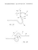 IMPLANTABLE ECHO DOPPLER FLOW SENSOR FOR MONITORING OF HEMODYNAMICS diagram and image