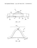 IMPLANTABLE ECHO DOPPLER FLOW SENSOR FOR MONITORING OF HEMODYNAMICS diagram and image