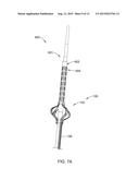 ENDOLUMINAL OSTIUM SENSOR ARRAY DEVICE diagram and image