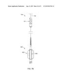 ENDOLUMINAL OSTIUM SENSOR ARRAY DEVICE diagram and image