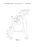 METHODS, ASSEMBLIES, AND DEVICES FOR POSITIONING A CATHETER TIP USING AN     ULTRASONIC IMAGING SYSTEM diagram and image