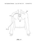 METHODS, ASSEMBLIES, AND DEVICES FOR POSITIONING A CATHETER TIP USING AN     ULTRASONIC IMAGING SYSTEM diagram and image