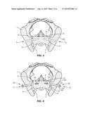 IMPLANT SYSTEM AND METHOD FOR STABILIZATION OF A SACRO-ILIAC JOINT diagram and image