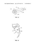 IMPLANT SYSTEM AND METHOD FOR STABILIZATION OF A SACRO-ILIAC JOINT diagram and image