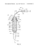 IMPLANT SYSTEM AND METHOD FOR STABILIZATION OF A SACRO-ILIAC JOINT diagram and image