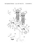 BONE FIXATION SYSTEM diagram and image