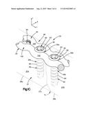 BONE FIXATION SYSTEM diagram and image