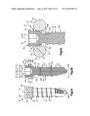 BONE FIXATION SYSTEM diagram and image