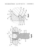 BONE FIXATION SYSTEM diagram and image