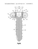 BONE FIXATION SYSTEM diagram and image