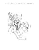 ADJUSTABLE DEVICES FOR TREATING ARTHRITIS OF THE KNEE diagram and image