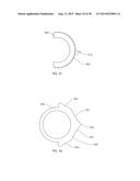 ADJUSTABLE DEVICES FOR TREATING ARTHRITIS OF THE KNEE diagram and image