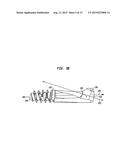 INTRAMEDULLARY FIXATION ASSEMBLY AND METHOD OF USE diagram and image