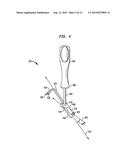 INTRAMEDULLARY FIXATION ASSEMBLY AND METHOD OF USE diagram and image