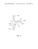 METHODS AND SYSTEMS FOR TREATING NERVE STRUCTURES diagram and image