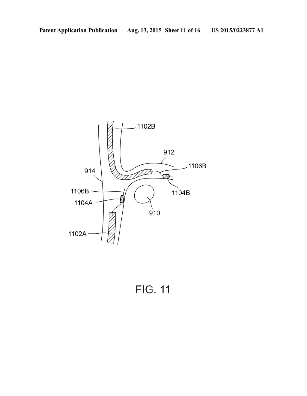 METHODS AND SYSTEMS FOR TREATING NERVE STRUCTURES - diagram, schematic, and image 12