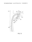 METHODS AND SYSTEMS FOR TREATING NERVE STRUCTURES diagram and image