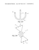 PERCUTANEOUS TRANSVALVULAR INTRAANNULAR BAND FOR MITRAL VALVE REPAIR diagram and image