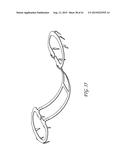 PERCUTANEOUS TRANSVALVULAR INTRAANNULAR BAND FOR MITRAL VALVE REPAIR diagram and image