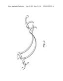 PERCUTANEOUS TRANSVALVULAR INTRAANNULAR BAND FOR MITRAL VALVE REPAIR diagram and image