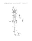 TELESCOPING URETERAL STENT diagram and image