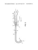 TELESCOPING URETERAL STENT diagram and image