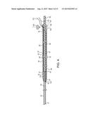 TELESCOPING URETERAL STENT diagram and image