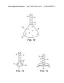 TELESCOPING URETERAL STENT diagram and image