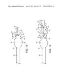 TELESCOPING URETERAL STENT diagram and image