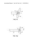 TELESCOPING URETERAL STENT diagram and image